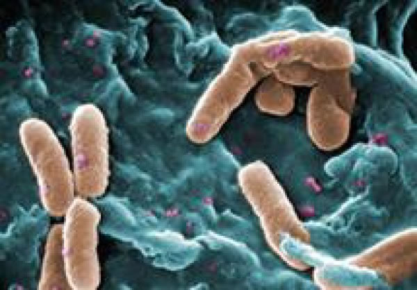 Sanitizantes, limpieza y orden en el control de plagas.