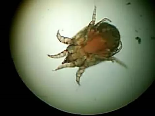 Sarna sarcoptes scabiei (ácaro de la sarna)